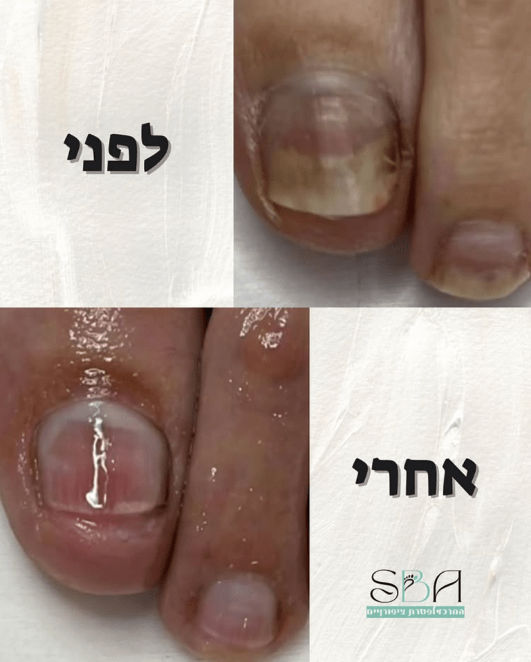 צילום מסך 2025-10-26 ב-10.01.23