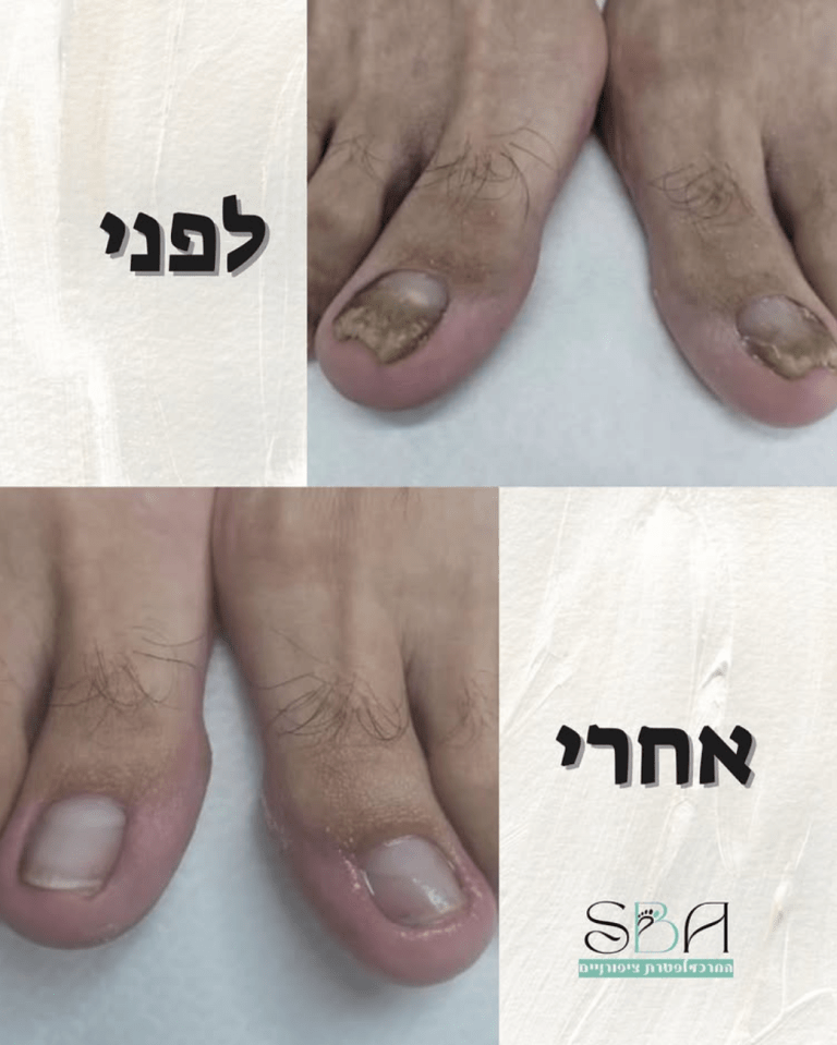 צילום מסך 2025-10-26 ב-10.01.55