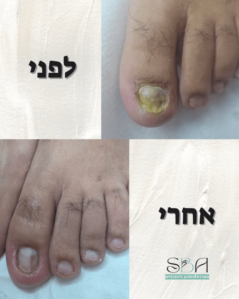 צילום מסך 2025-10-26 ב-10.02.17